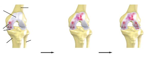 The joint of the knee joint