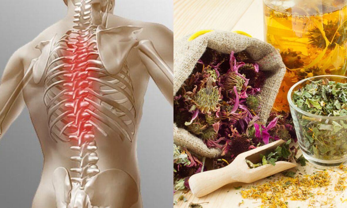 folk methods for osteochondrosis of the neck