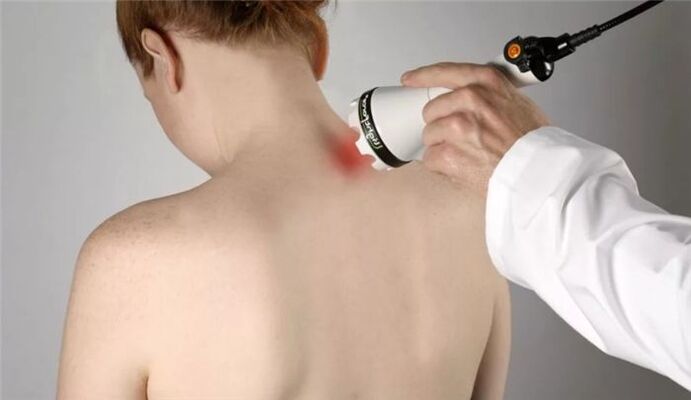 physiotherapy for the treatment of cervical osteochondrosis