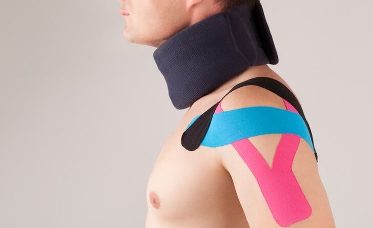 During the acute period of cervical osteochondrosis, a special collar must be worn